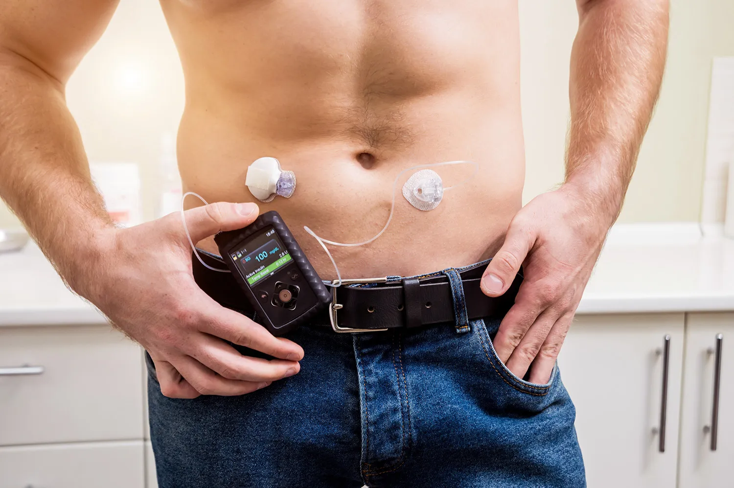 Insulin Pump Therapy